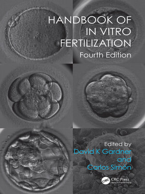 cover image of Handbook of In Vitro Fertilization